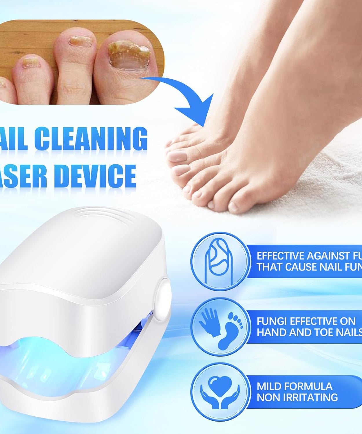 Rechargeable Nail Fungus Laser – Anti-Fungal Device for Toenails, Hands & Feet (Home Use)