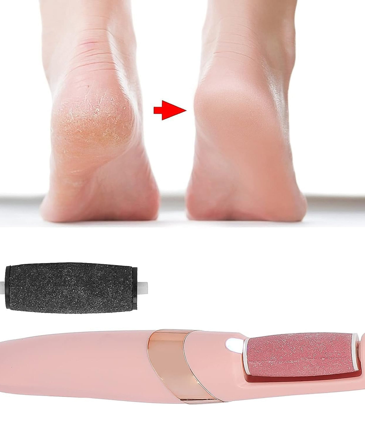 Flewless Pedi Electronic Pedicure Tool (1 Set)