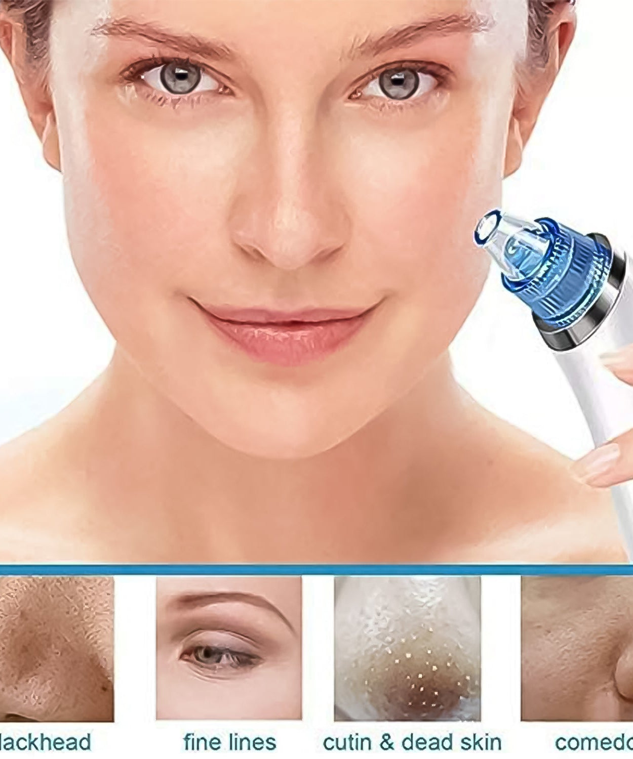 2 in 1 Blackhead Whitehead Extractor Remover Device (Multi-Color / 1 Set / batteries not included)