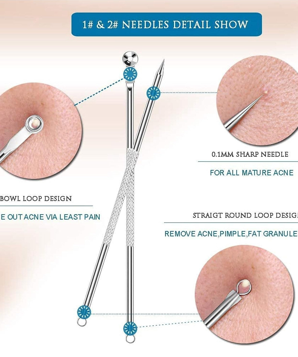 Blackhead Remover, 4-in-1 Stainless Steel Pimple Extractor Tool (1 Pc)