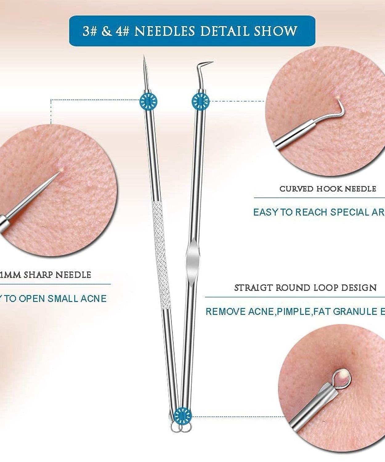 Blackhead Remover, 4-in-1 Stainless Steel Pimple Extractor Tool (1 Pc)