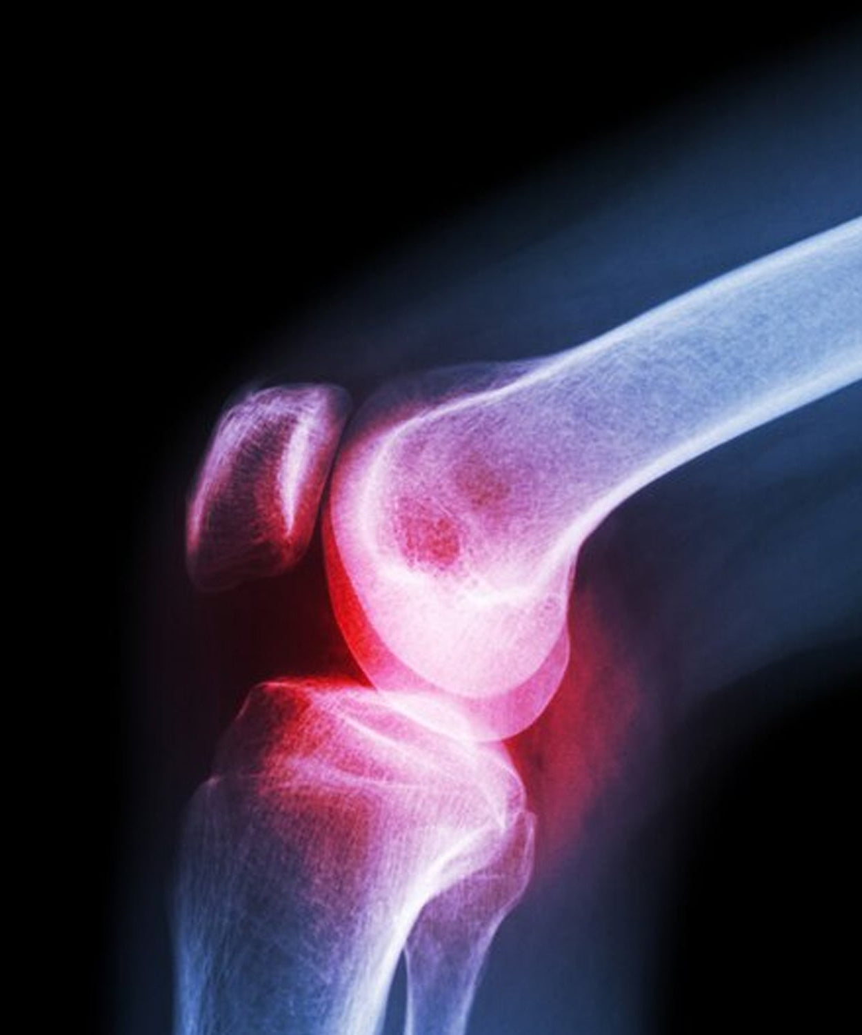 Large knee cap, enhances comfort and stability