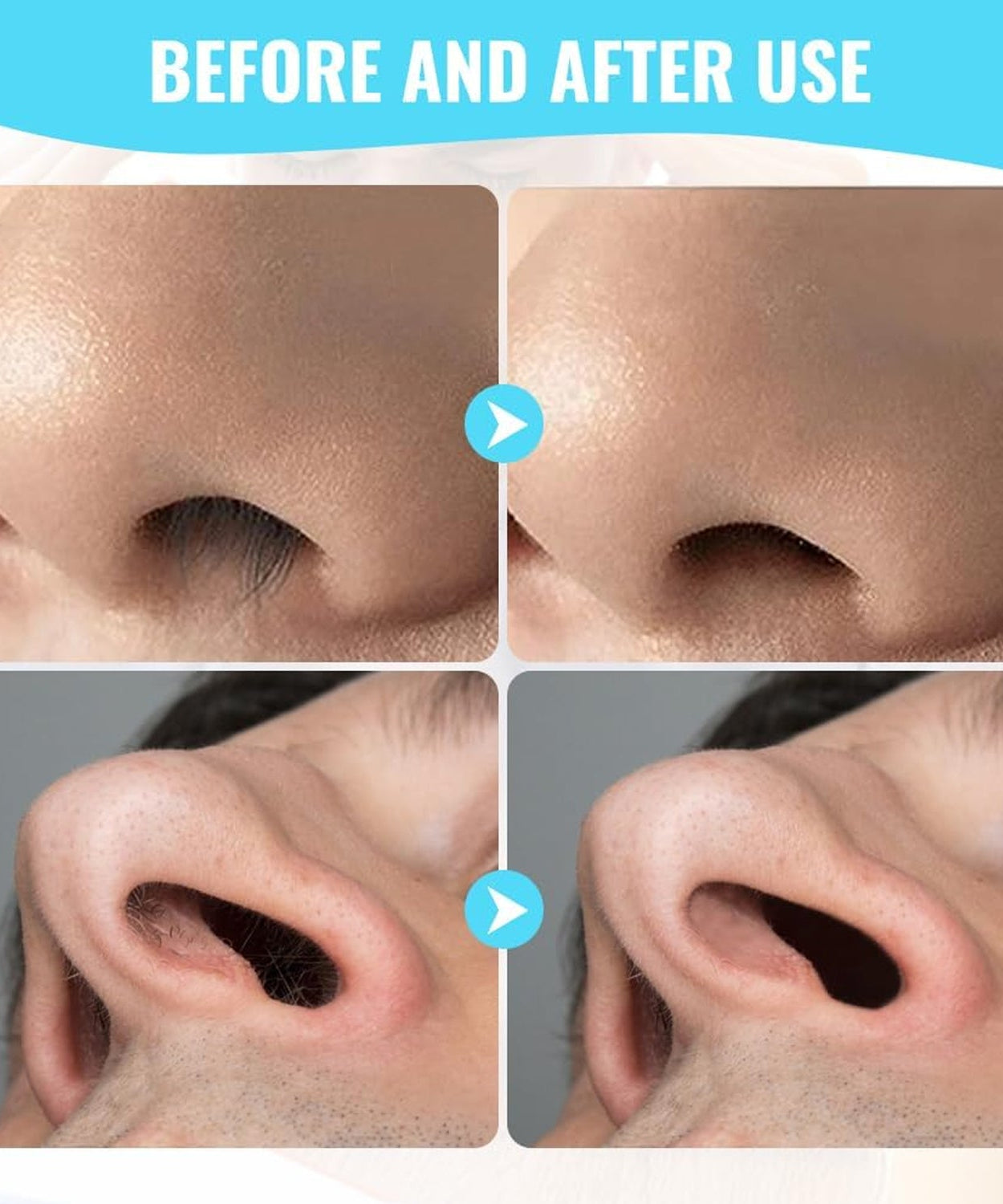 Nose Hair Removal Trimmer Nose Hair Remover Razor Kit Blade (3 Pcs Set)